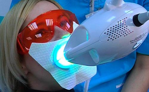 Whitening zoom under the lamp