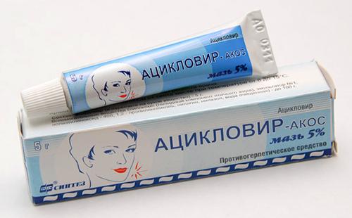Acyclovir will help gentle lips
