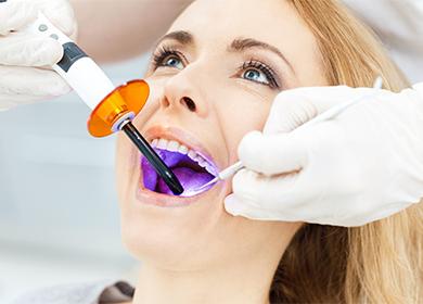 Professional teeth whitening