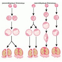 The figure shows how this or that twins