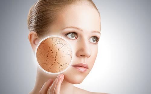 Dry skin