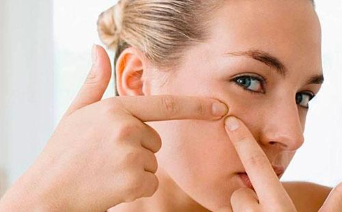 Girl squeezes black dots on her face