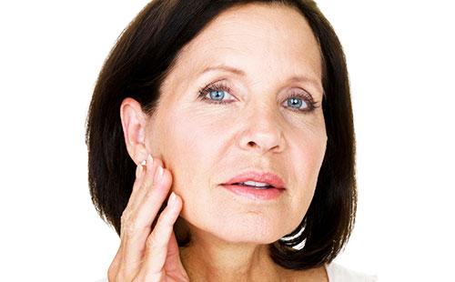 Muscle type of facial aging