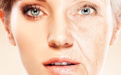 Facial aging