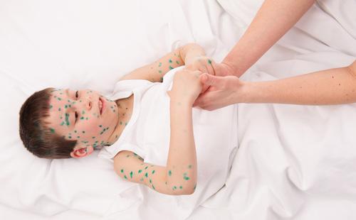 The child smeared with green