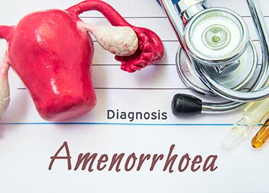 Medical model of female internal organs