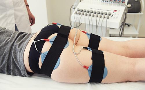 Buttock myostimulation