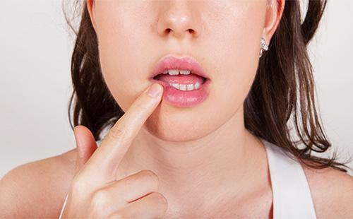 Herpes on the lips