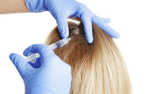 Injection into the scalp