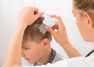 Combing lice and nits