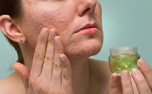 Women rubs skin with lotion