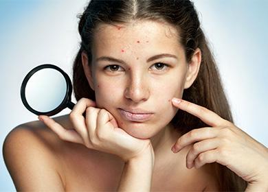 Woman with problem skin