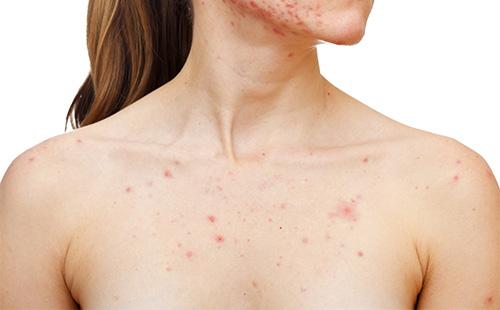 Pin on the girl's chest