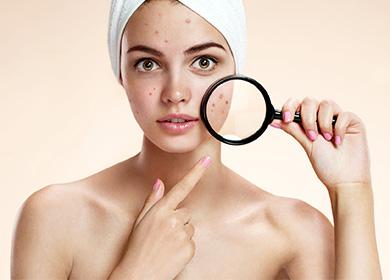 Girl examines her skin through a magnifying glass