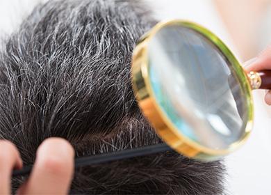 The doctor examines the patient's hair