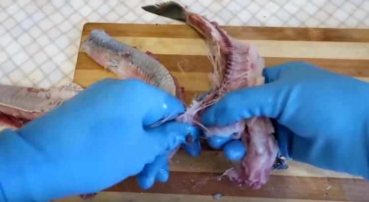 We remove the ridge.