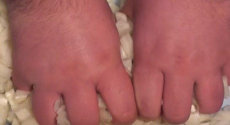 Finely chop the onion and knead it with your hands.